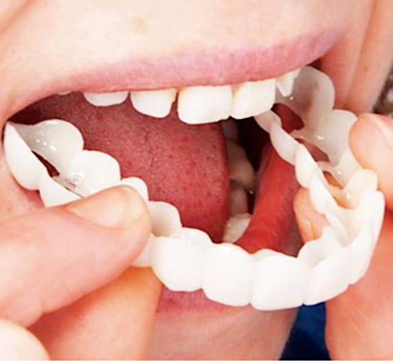 Perfect Smile™️ Snímateľné zubné náhrady (horná + dolná sada)