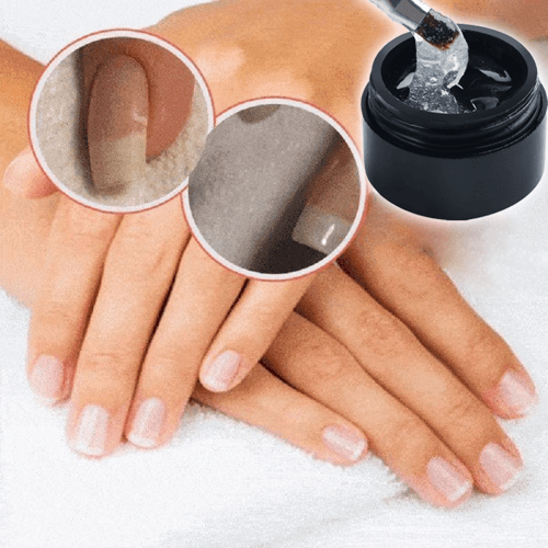 NailRepair™ – Sofortiges Nagelschutzgel 